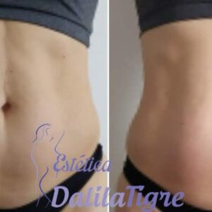 dalilatigreestetica00011