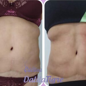 dalilatigreestetica00012