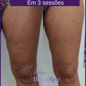 dalilatigreestetica00015