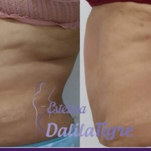 dalilatigreestetica00016