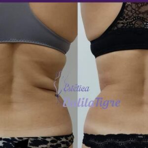 dalilatigreestetica00017