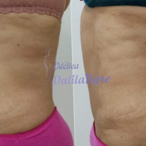 dalilatigreestetica00010